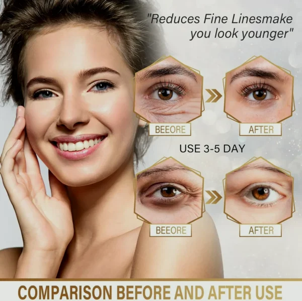 24K Gold Under Eye Mask for Puffiness