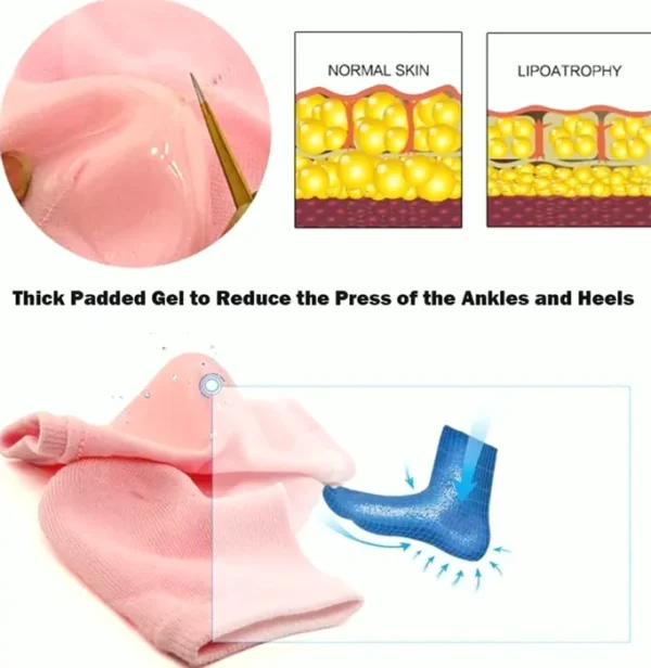 Ultimate Dry Heel Treatment Moisturizers 2-Pairs