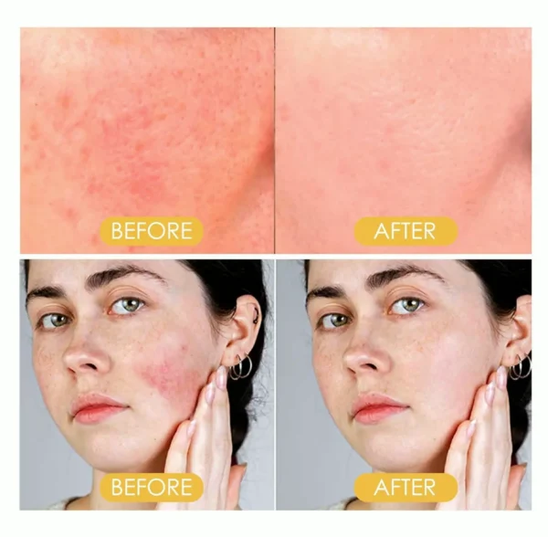 Sun Protection Fixing Powder SPF Face Moisturizer