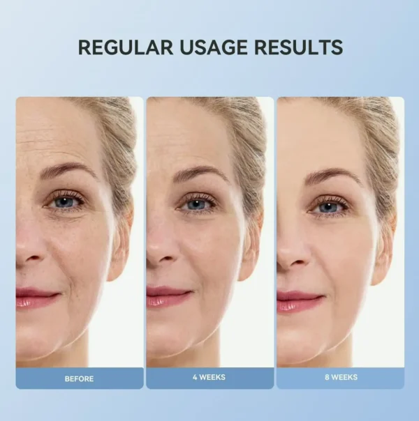 Cutting-edge Retinol Cream - Reduces Fine Lines