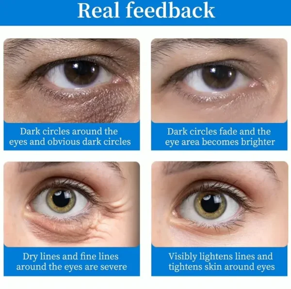 Under Eye Patches (Pieces) - Illuminating Eye Mask with HA, Cooling Care for Puffy Eyes & Dark Circles, Reduce Eye Bags and Smooth Lines