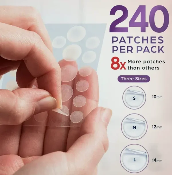 KEYCONCEPTS BHA Zit Patches (240 Pack)