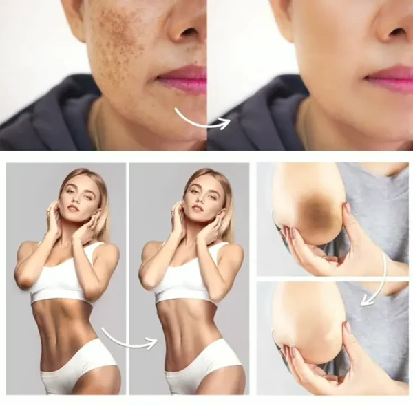 Intimate Area Blemish Corrector - Underarm Cream for Various Areas