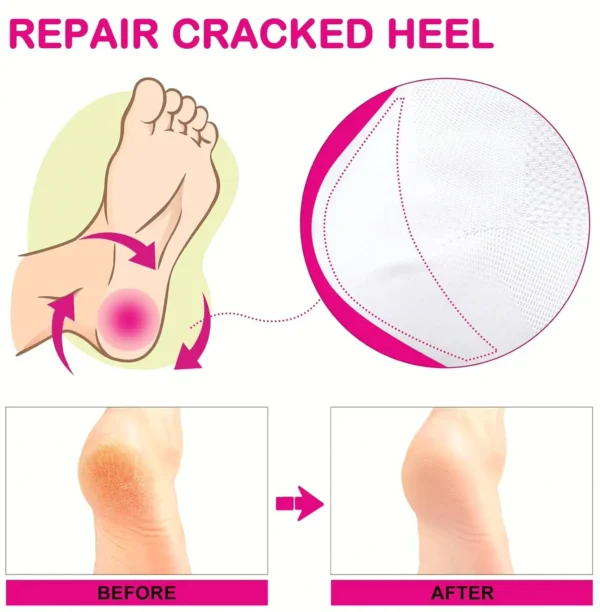 Moisturizing Healing Foot Wraps - 3 Pairs Open-Toe Spa Wraps for Cracked Heels