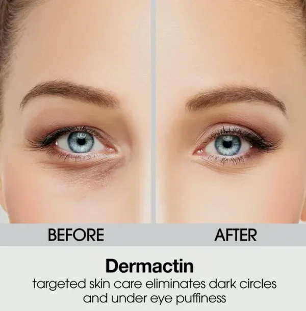 Upper Eyelid Cream - Dermactin 1 Fluid Oz