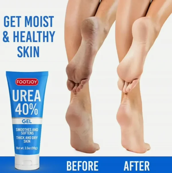 Urea Gel 40% for Cracked Heels, Hands