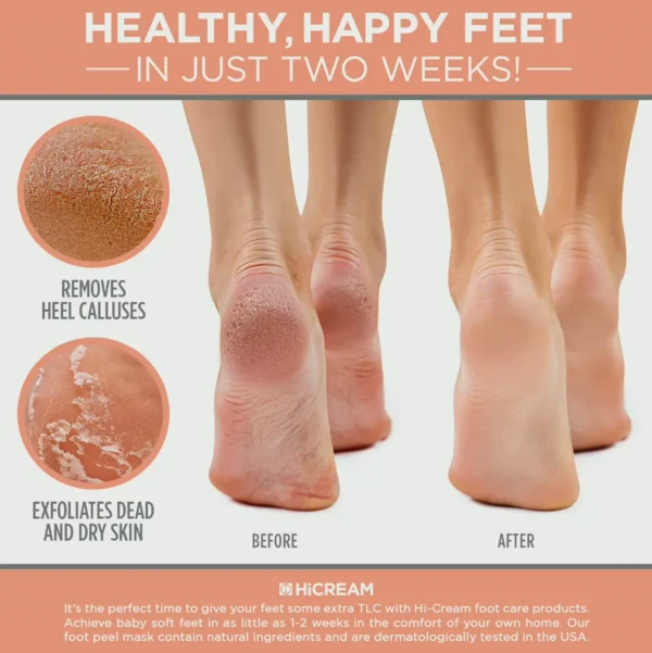 Footcare Peel Treatment - 2 pairs, Peach Scent