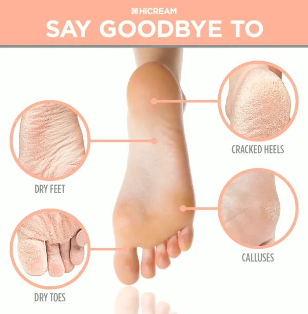 Footcare Peel Treatment - 2 pairs, Peach Scent