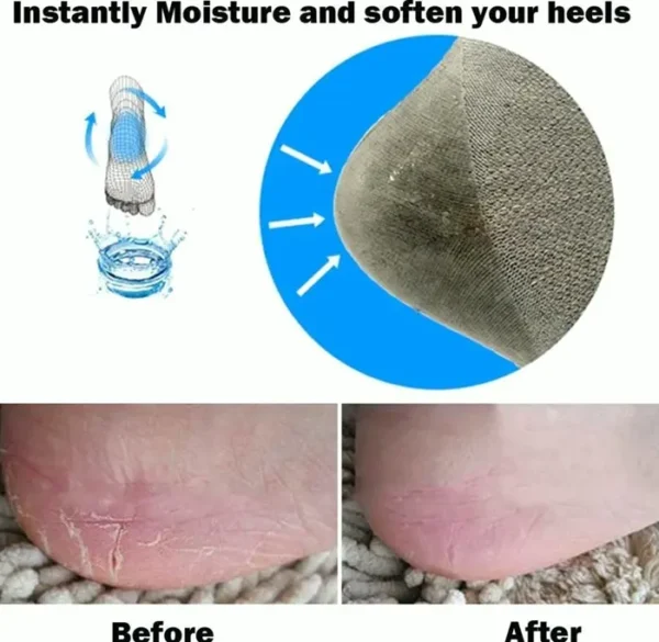 Ultimate Dry Heel Treatment Moisturizers 2-Pairs