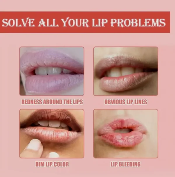 3 Bee Lip Balm Honey Pot - Exfoliating Lip Mask